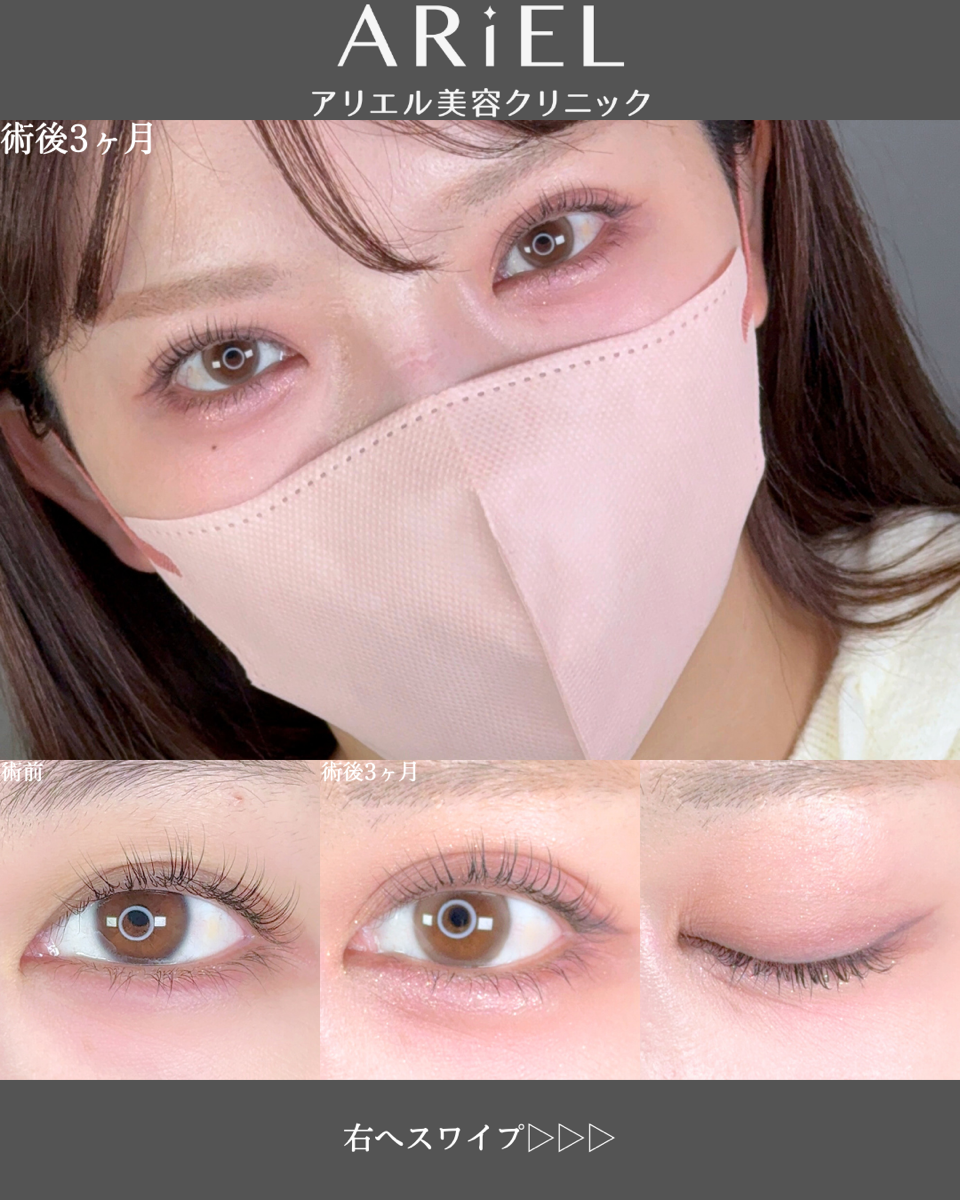 No.8675の症例写真